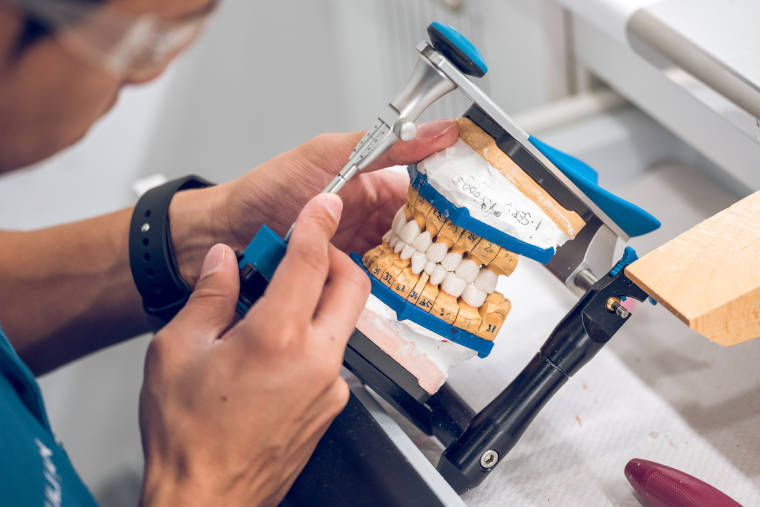 Prothetik / hochwertiger ästhetischer Zahnersatz in der Zahnarztpraxis Dr. med. dent. Uta Löffler in Zittau